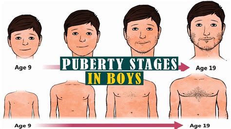 teen hard|Stages of Puberty Explained in Pictures